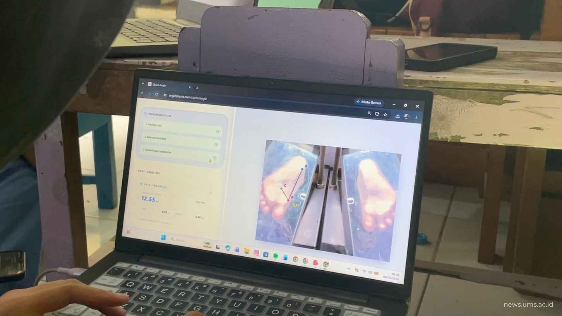Mahasiswa Fisioterapi UMS Kembangkan Alat Deteksi Lengkung Kaki pada Anak